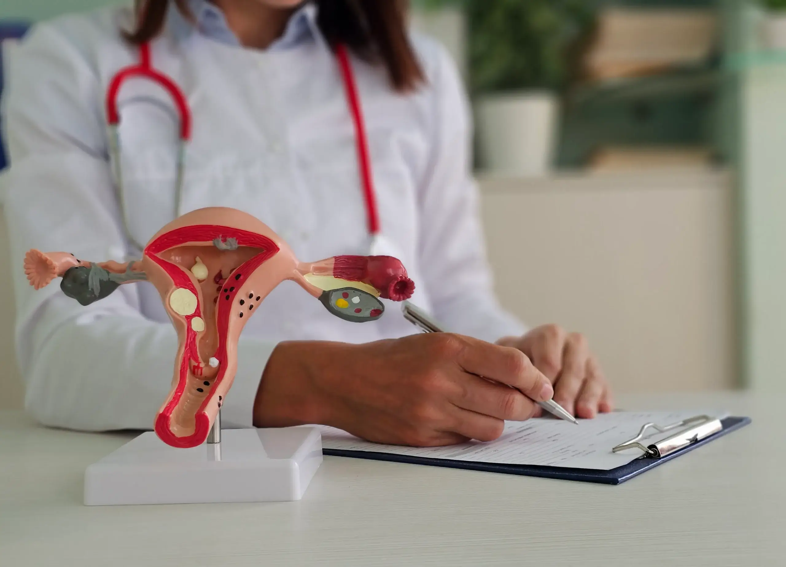 O cuidado da Clínica Salvata na istmocele