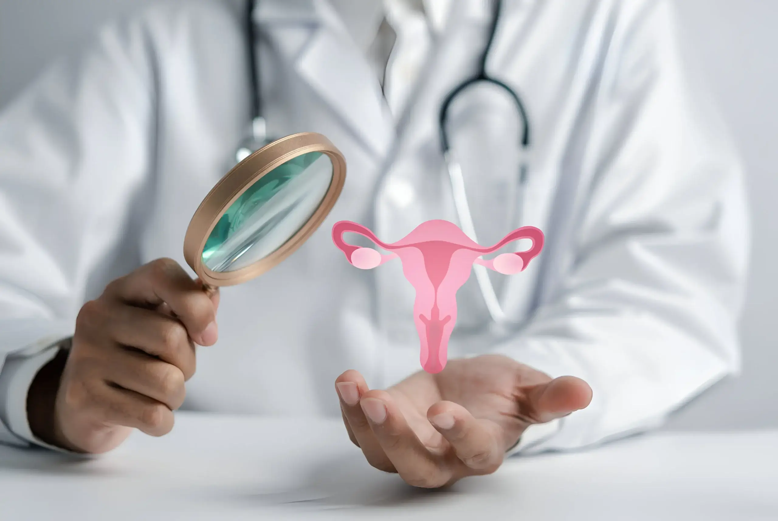 Malformações Uterinas
